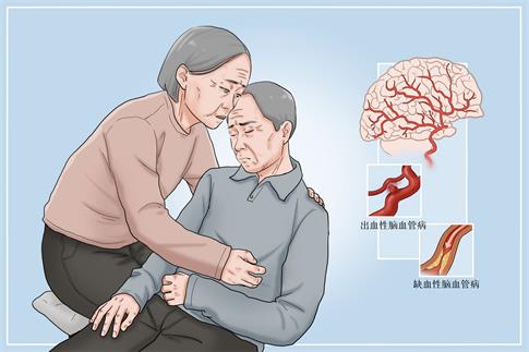 1665702670159558.jpg 攝圖網(wǎng)_401926692_banner_中風(fēng)發(fā)病暈倒醫(yī)療插畫(非企業(yè)商用).jpg